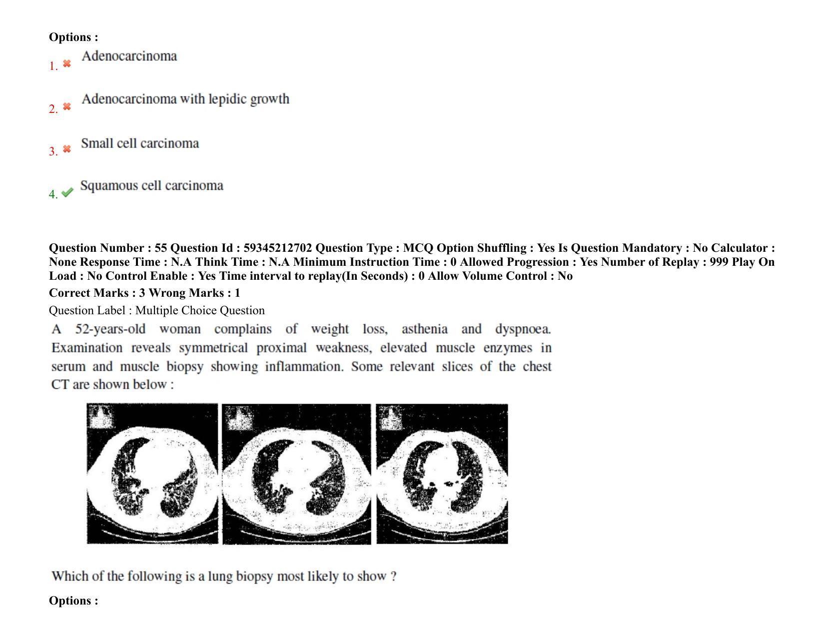 BHU RET T.B. & Chest Diseases 2021 Question Paper - Page 45