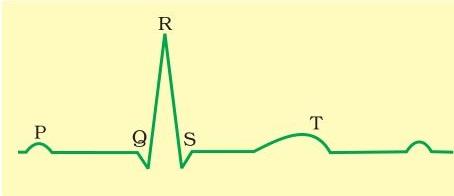 Standard ECG NCERT Solutions for 11th Class Biology: Chapter 18-Body Fluids and Circulation Que.14