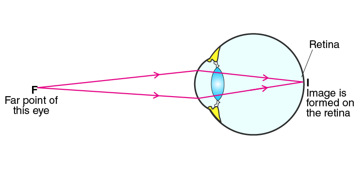 Lakhmir Singh Solutions Class 10 Physics Chapter 6 -16 Lakhmir Singh Solutions Class 10 Physics Chapter 6 -16