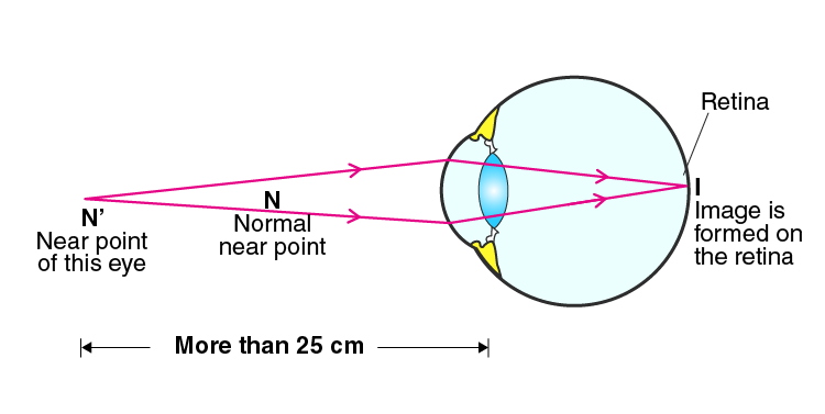 Lakhmir Singh Solutions Class 10 Physics Chapter 6 -19 Lakhmir Singh Solutions Class 10 Physics Chapter 6 -19