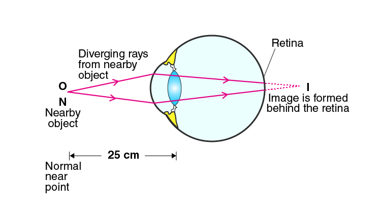 Lakhmir Singh Solutions Class 10 Physics Chapter 6 -5 Lakhmir Singh Solutions Class 10 Physics Chapter 6 -5