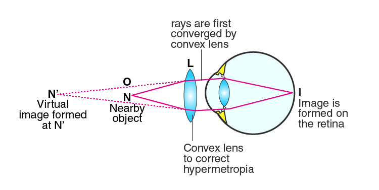 Lakhmir Singh Solutions Class 10 Physics Chapter 6 -6 Lakhmir Singh Solutions Class 10 Physics Chapter 6 -6