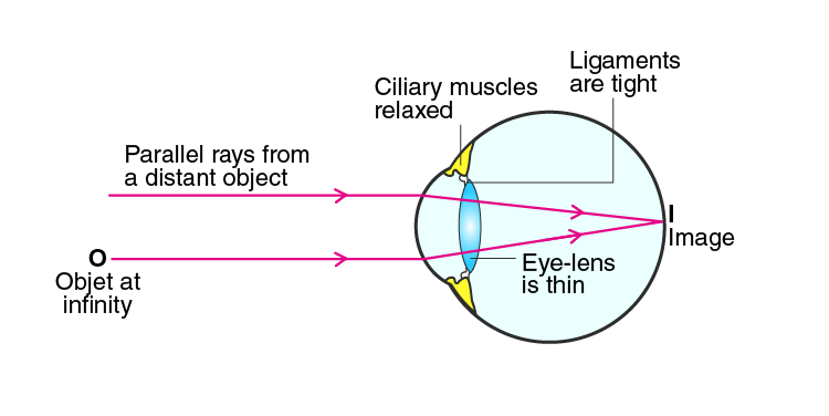 Lakhmir Singh Solutions Class 10 Physics Chapter 6 -7 Lakhmir Singh Solutions Class 10 Physics Chapter 6 -7